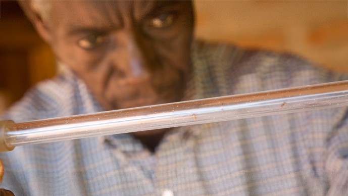 Can Bacteria Protect Against HIV?