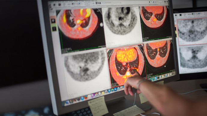 Understanding the Tuberculosis Bacterium for Drug Discovery