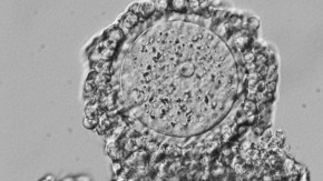 Contraceptive Discovery