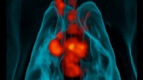 /sites/default/files/styles/listing_image/public/3d%20reconstruction%20of%20PET/CT%20scan?itok=xSLPFKU5