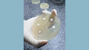 Pathogen Identification